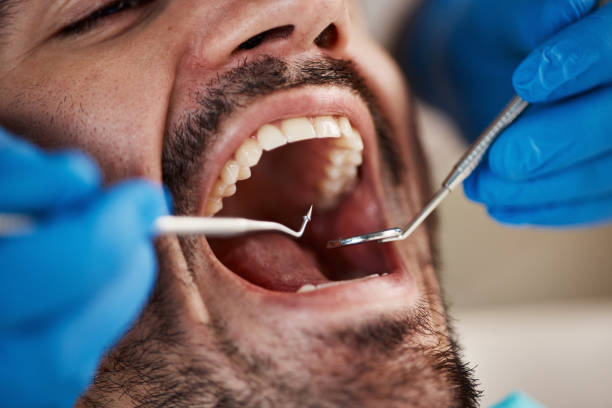 Best Chipped Tooth Repair Near Me  in Boerne, TX